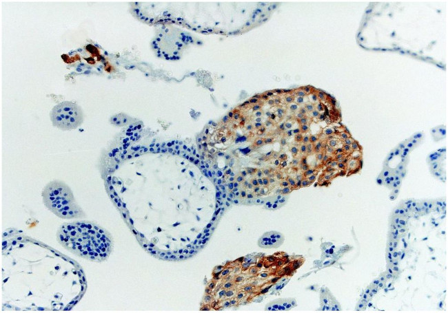 HLA-G Antibody in Immunohistochemistry (Paraffin) (IHC (P))