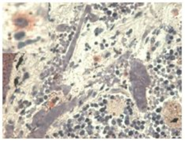 HLA-G Antibody in Immunohistochemistry (Paraffin) (IHC (P))