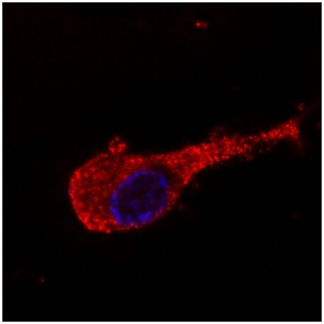 NEFM Antibody in Immunocytochemistry (ICC/IF)