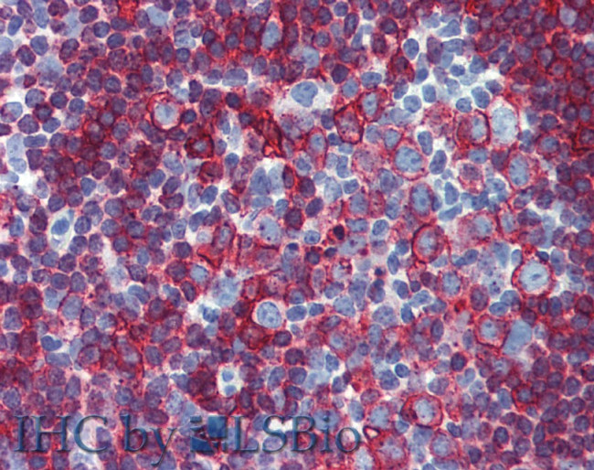 HLA-DR/DP Antibody in Immunohistochemistry (Paraffin) (IHC (P))