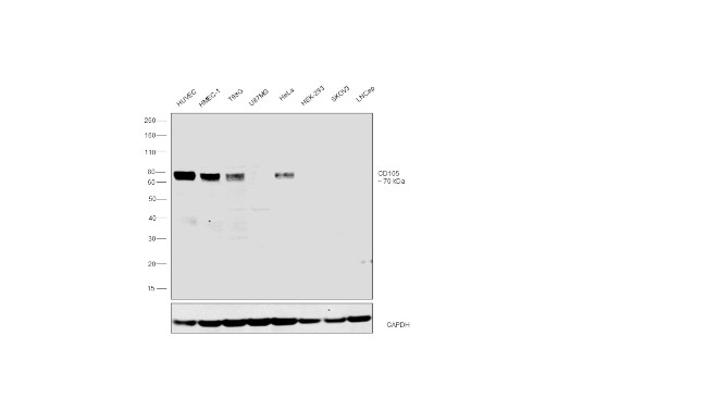 CD105 Antibody in Western Blot (WB)