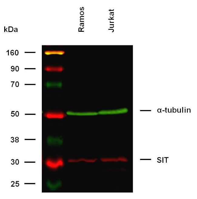 SIT Antibody in Western Blot (WB)