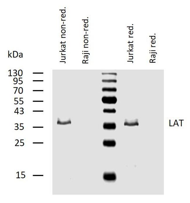 LAT Antibody in Western Blot (WB)