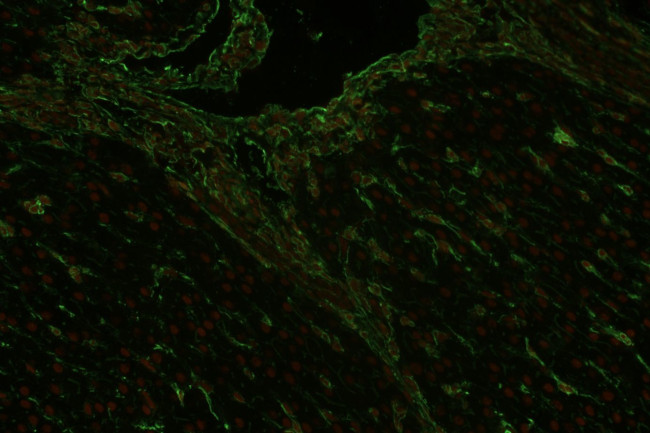 Vimentin Antibody in Immunohistochemistry (Paraffin) (IHC (P))