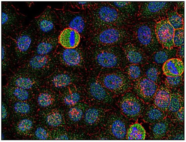 Fyn Antibody in Immunocytochemistry (ICC/IF)