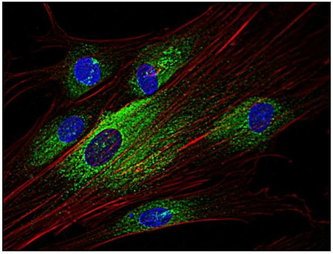 Syk Antibody in Immunocytochemistry (ICC/IF)