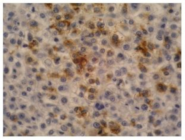 AFP Antibody in Immunohistochemistry (Paraffin) (IHC (P))