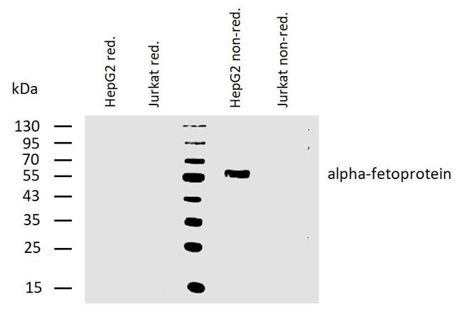 AFP Antibody in Western Blot (WB)