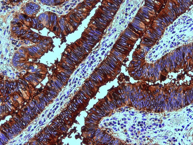 MUC5AC Antibody in Immunohistochemistry (Paraffin) (IHC (P))