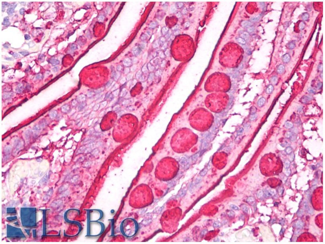 MUC5AC Antibody in Immunohistochemistry (Paraffin) (IHC (P))