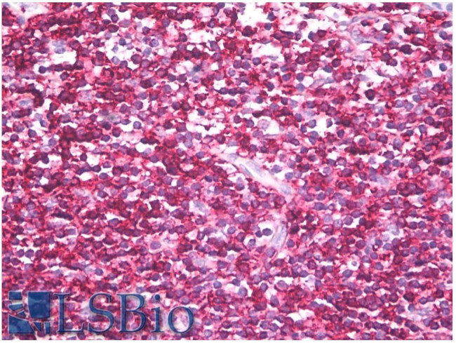 CD45RB Antibody in Immunohistochemistry (Paraffin) (IHC (P))