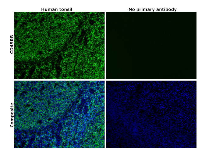 CD45RB Antibody in Immunohistochemistry (Paraffin) (IHC (P))