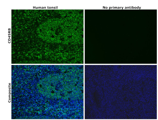 CD45RB Antibody in Immunohistochemistry (Paraffin) (IHC (P))