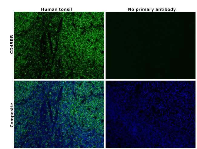 CD45RB Antibody in Immunohistochemistry (Paraffin) (IHC (P))