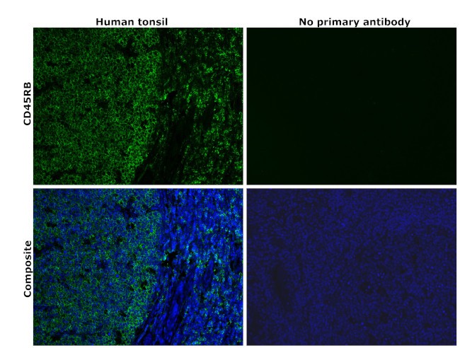 CD45RB Antibody in Immunohistochemistry (Paraffin) (IHC (P))