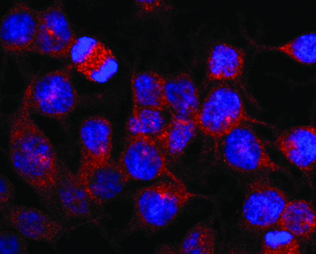 Kinesin 5B Antibody in Immunocytochemistry (ICC/IF)