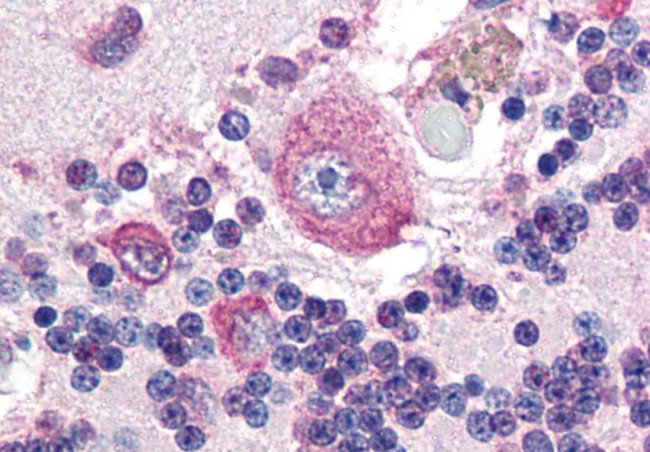 Placental Alkaline Phosphatase Antibody in Immunohistochemistry (Paraffin) (IHC (P))