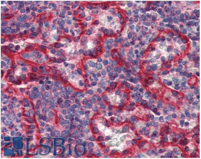 HLA-E Antibody in Immunohistochemistry (Paraffin) (IHC (P))