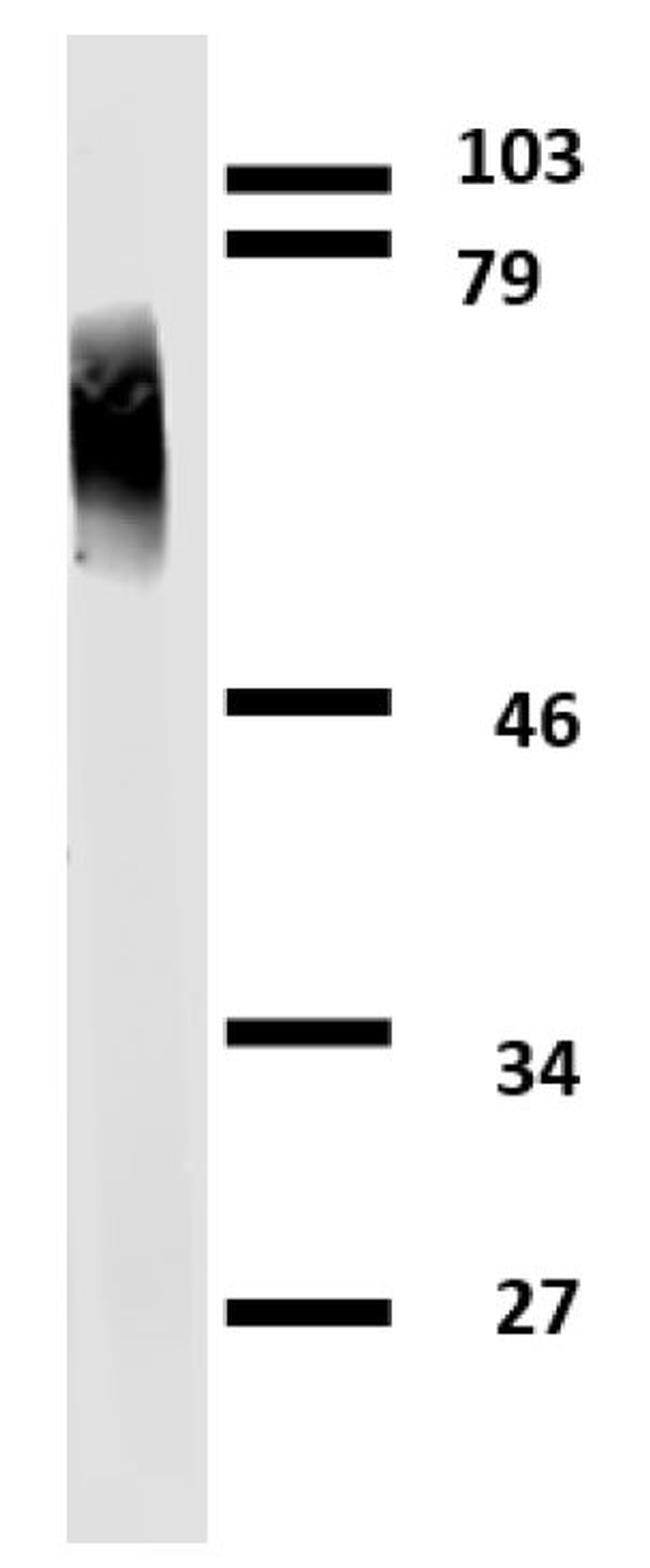 Apolipoprotein J Antibody in Western Blot (WB)