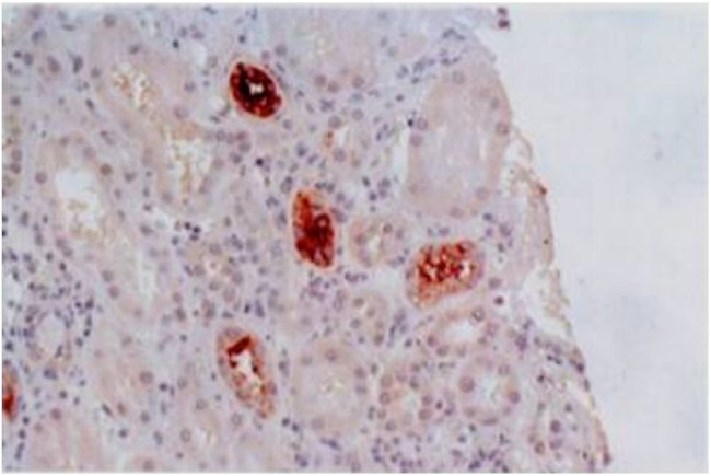 HLA-G Antibody in Immunohistochemistry (Paraffin) (IHC (P))