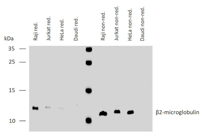 beta-2 Microglobulin Antibody in Western Blot (WB)