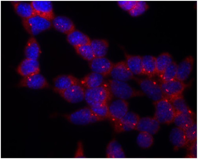 gamma Tubulin Antibody in Immunocytochemistry (ICC/IF)