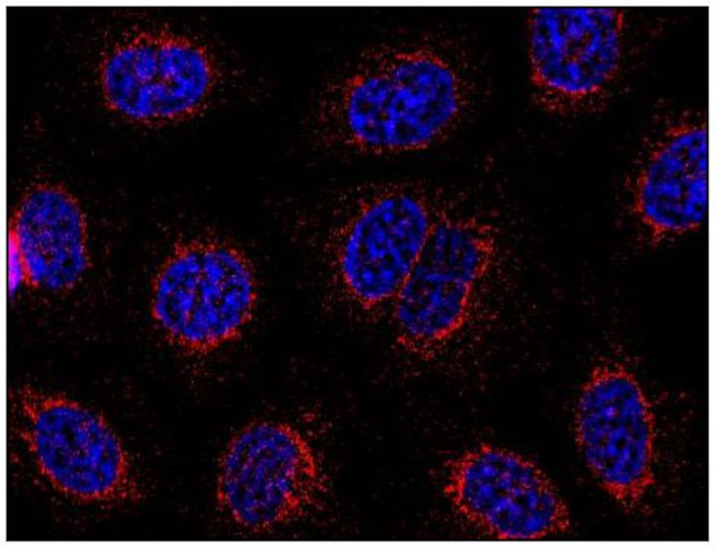 STIM1 Antibody in Immunocytochemistry (ICC/IF)