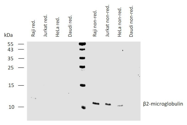 beta-2 Microglobulin Antibody in Western Blot (WB)