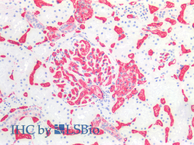 Blood Group A Antigen Antibody in Immunohistochemistry (Paraffin) (IHC (P))