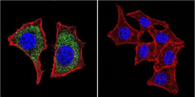 beta Catenin Antibody in Immunocytochemistry (ICC/IF)