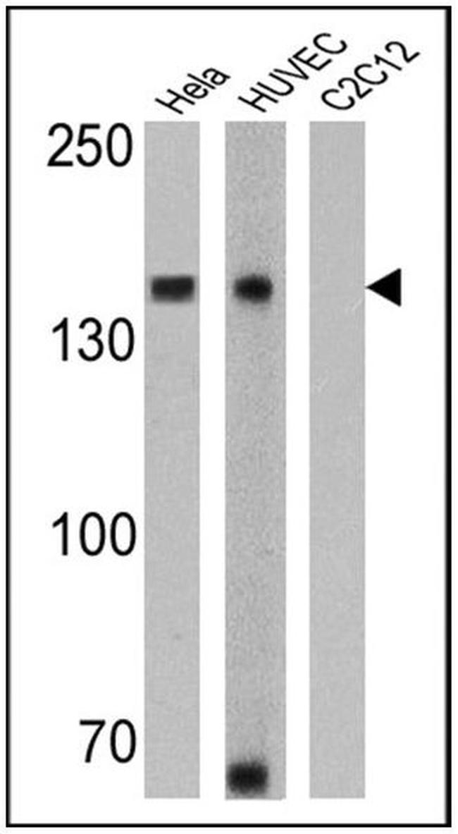 N-cadherin Antibody in Western Blot (WB)