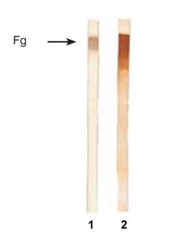 Fibrinogen Antibody in Western Blot (WB)