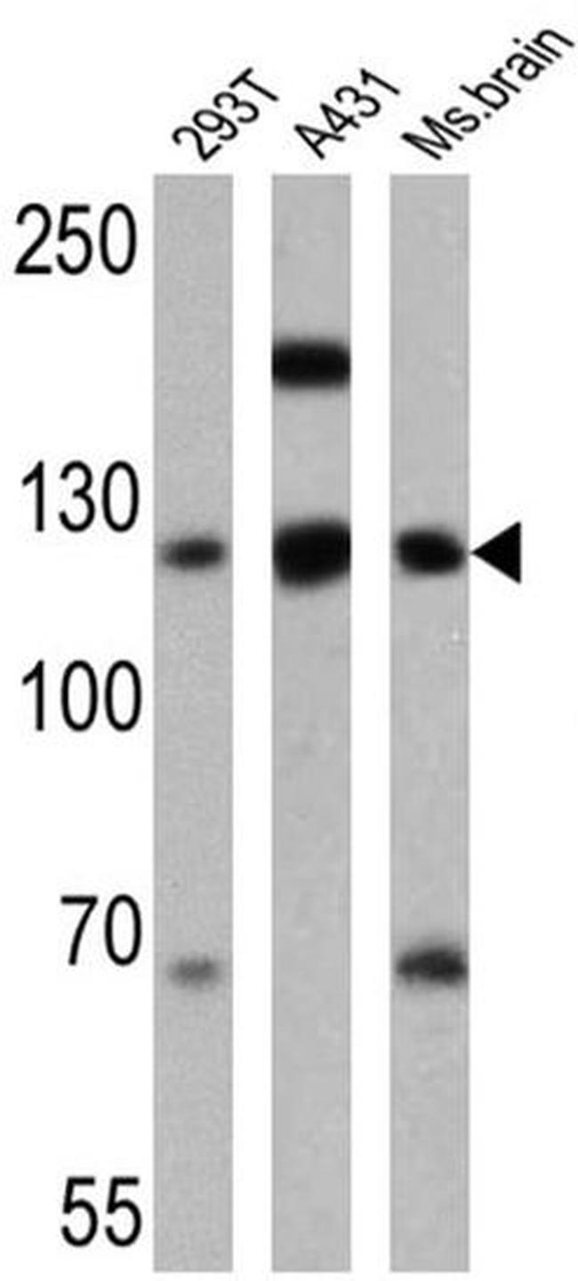 P-cadherin Antibody in Western Blot (WB)