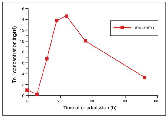 S100 Antibody in ELISA (ELISA)