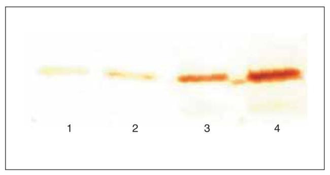 Cardiac Troponin I Antibody in Western Blot (WB)