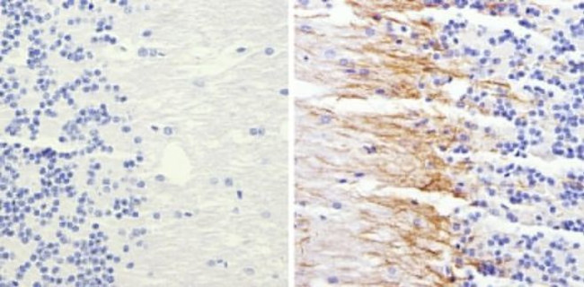 NEFM Antibody in Immunohistochemistry (Paraffin) (IHC (P))