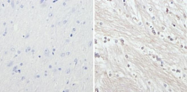 NF-H Antibody in Immunohistochemistry (Paraffin) (IHC (P))