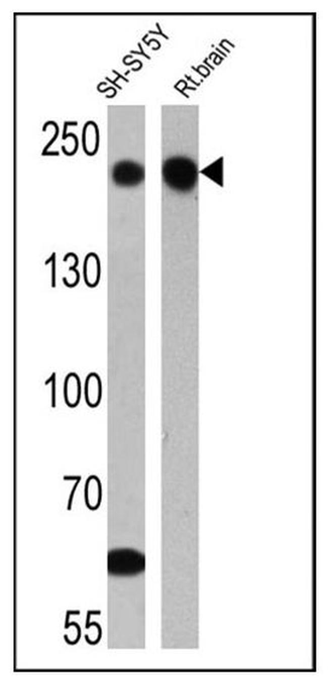 NF-H Antibody in Western Blot (WB)