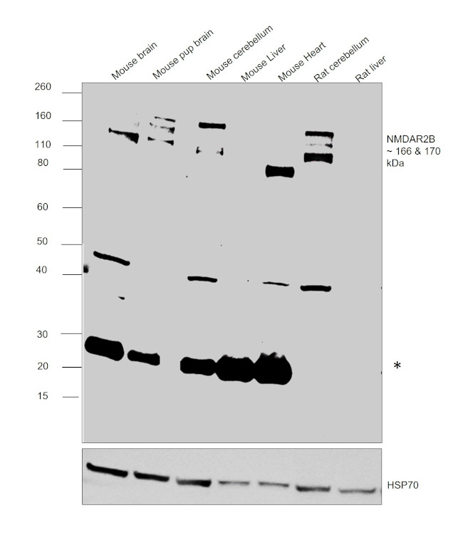 NMDAR2B Antibody in Western Blot (WB)