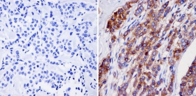 NMDAR2B Antibody in Immunohistochemistry (Paraffin) (IHC (P))