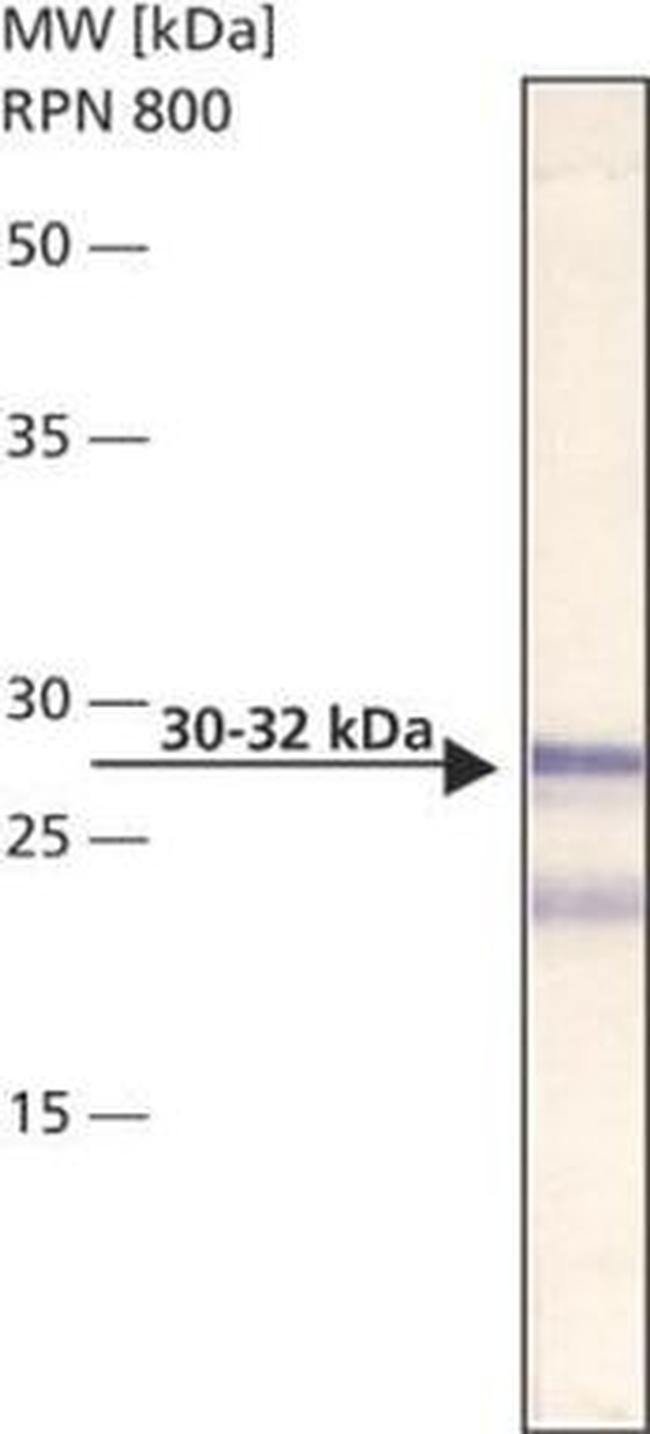 Bcl-10 Antibody in Western Blot (WB)
