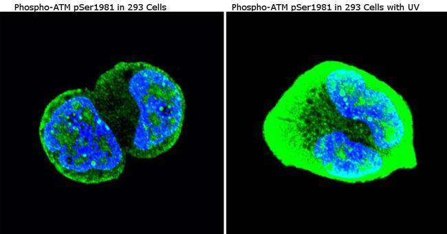 Phospho-ATM (Ser1981) Antibody