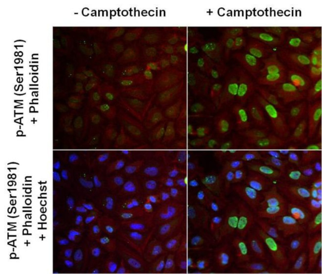 Phospho-ATM (Ser1981) Antibody in Immunocytochemistry (ICC/IF)