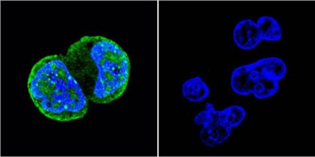 Phospho-ATM (Ser1981) Antibody in Immunocytochemistry (ICC/IF)