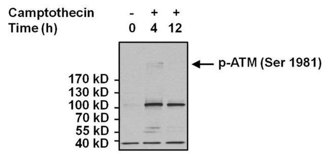 Phospho-ATM (Ser1981) Antibody in Western Blot (WB)