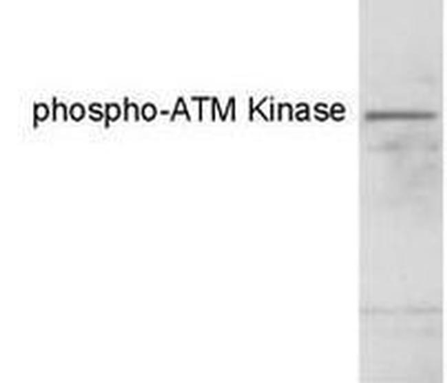 Phospho-ATM (Ser1981) Antibody in Western Blot (WB)