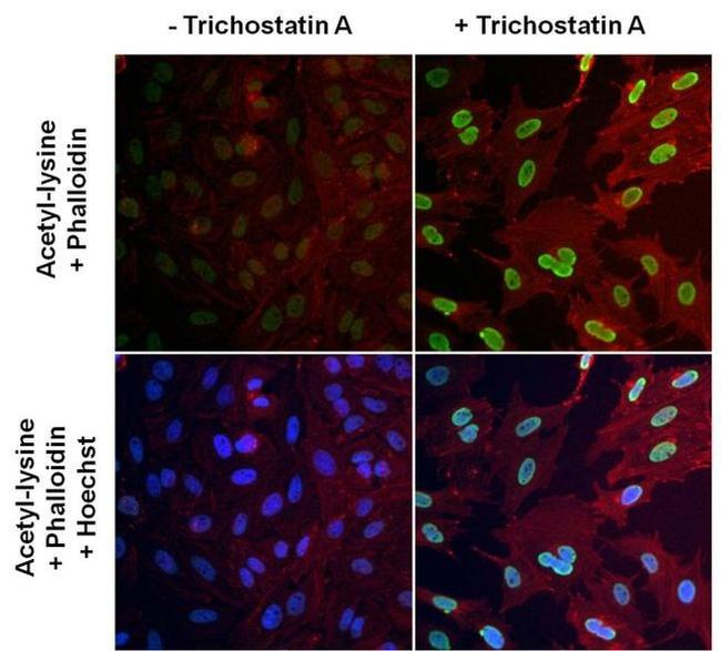 Acetylated Lysine Antibody