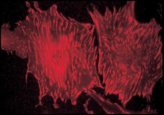 Talin Antibody in Immunohistochemistry (IHC)