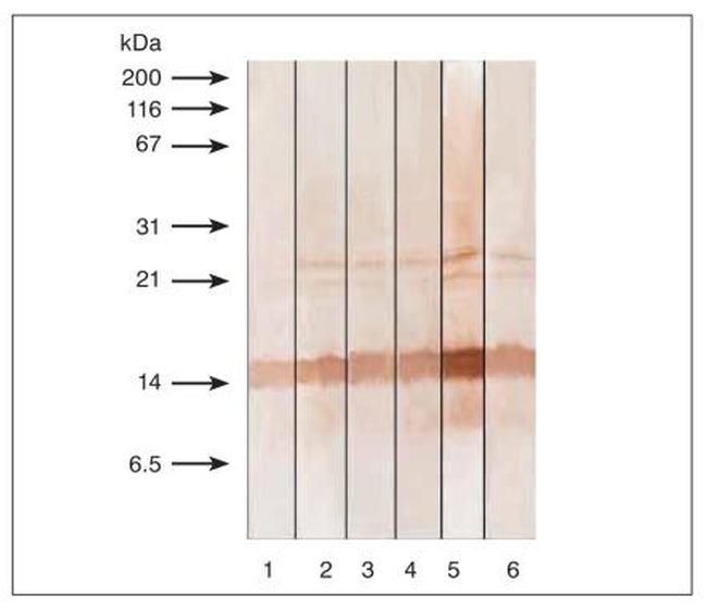 Calcitonin Antibody in Western Blot (WB)