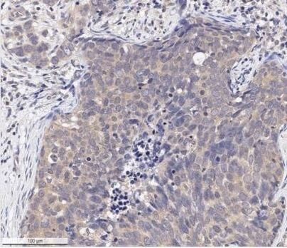 Phospho-AKT1 (Ser473) Antibody in Immunohistochemistry (Paraffin) (IHC (P))